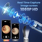 Ear Wax Removal 1080p Remover Cleaner With Camera Tool Otoscope Waterproof Gifts