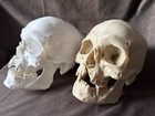 Human Skull Replica   Life Size   Battle Damaged Warrior   Anatomical Model