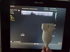 Philips L12-4 Linear Array Probe Ultrasound Transducer - Working - Cord Damage