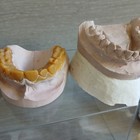 Vintage Lot Of Dentist Orthodontist Teeth Casts Molds Retainers 1970s 80s Oddity