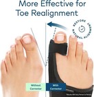 4 Pack Treatmedy Bunion Fix Toe Valgus Corrector Adjustable Orthosis Splints