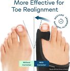 Treatmedy Bunion Fix Toe Valgus Corrector Adjustable Orthosis Splints  1 Pair 