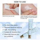 Scar Cream For Surgical Scars  Burn Scar  Acne Scar Treatment Scar Removal Cream