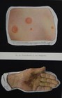 Antique Anatomy Art Print Medical Human Hands Halloween Original 1914