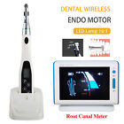 Endodontic Dental Led Endo Motor  apex Locator Root Canal  niti Rotary File