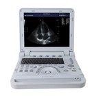 Portable Ultrasound Scanner Color Doppler Diagnostic Laptop Machine 3 Probes Cf