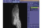 Podiatry X-cell 20 20 With 2024 Canon Upgrade