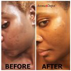 Scented Liquid 16 Oz  Raw African Black Soap 100  Natural Organic Face Body Wash