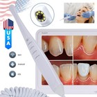 Dental Intra Oral Camera 16 Megapixel Intraoral Camera With 17 Inch Lcd Monitor
