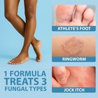 Curist Terbinafine Cream Antifungal 1oz  30g  Foot 1 Ounce  pack Of 1   White