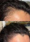 Viviscal Hair Growth Dietary Supplement With Collagen Complex 60 Tab 2027expiry