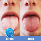 Stainless Steel Tongue Scraper Set - Fresh Breath Tongue Cleaners  2 Pack 