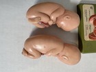 Vintage Somso West Germany Anatomical  Embryo Model Set Medical Teaching Twins