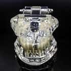 Dental Model Teeth Implant Restoration Bridge Teaching Study Dentist Dentistry