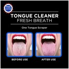 Tongue Scraper 2 Count Gentle Brush Fresh Breath Dentek Orabrush Cleaner