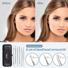 Blackhead Remover Comedone Extractor Acne Removal Kit  
