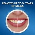 Wng 2-in-1 Teeth Strips  Day Whitening Night Repair  Peroxide-free Non-sensitive