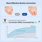 2-pack Bunion Corrector For Women   Men  Adjustable Big Toe Straightener   Pain 