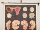 Pregnancy Fertilization Development 1960 Wall Chart Wall Picture 83x114cm