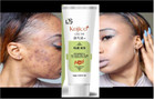 Kojic Acid Skin Whitening Lightening Ultra Brightening Cream Dark Spot Cream