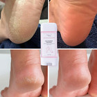 Foot Moisturizer Cream For Dry Cracked Heels And Feet Hydrate Rough Skin