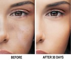 Skin Whitening Lightening Brightening Serum Kojic Acid Dark Spot Bleaching Cream