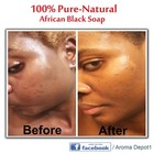 Moringa Black Soap Herbal Vegan Organic Unrefined 100  Natural Anti Acne fungus