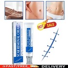 Scar Removal Cream Skin Repair Scar Remover Acne Treatment  Fade Stretch Mark