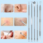 Acne Needle Blackhead Remover Pimple Blemish Comedone Extractor Tweezer Tool Kit