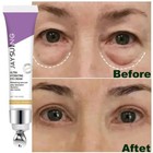Retinol Eye Cream Remover Dark Circles Eye Bags Anti Wrinkle Anti Puffiness Skin