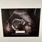 Kate   Milo Rustic Sonogram Love At First Sight Frame New