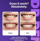 New Dr dent Purple Whitening Strips   Peroxide Free Gentle Teeth Whitening 14 Ct