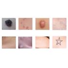 Tattoo Freckle Pigment Scar Removal Machine High-tech Facial Beauty Machine