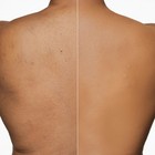 Dermablend Leg And Body Makeup 3 4 Fl Oz  pack Of 1   45w Tan Honey 