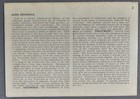 1910 Medical Skin Disease Stereoview Card  2 Acne Indurata  Rainforth