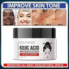 Authentic Kojie San Skin Brightening Cream Original Kojic Acid Cream - 50g Usa