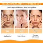 2pcs Turmeric Retinol Eye Stick lumibalm For Under Eyes Bags eye Balm Stick Wrin
