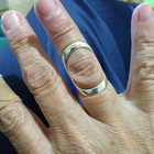 Adjustable Sterling Silver Handmade Splint Arthritis Ring Jewelry All Size 3-14