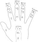 Patented Alaska Pik  pick  2 Picks Guitar Or Banjo Finger Pick Large