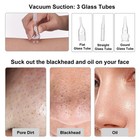 Mcwdoit Microdermabrasion Machine 3-in-1 0-68cmhg Suction