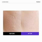 Frankly Closer Serum   Pore Minimizer   1 01 Fl Fl Oz  pack Of 1 