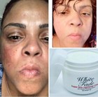 Super Skin Lightener Cream  Eliminan Las Manchas Oscuras Para Piel Clara  5oz 