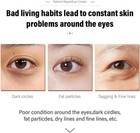 Retinol Eye Cream  Eye Bags Removal To Fight Fine Lines  Wrinkles   Dark Spots 