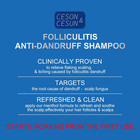 Anti-fungal anti Dandruff 2 In 1 Shampoo For Folliculitis  Scalp Psoriasis   Seb