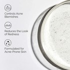 The Ordinary Salicylic Acid 2  Solution  Exfoliating Serum For Acne