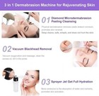 Unoisetion     diamond Microdermabrasion Machine Professional 3 In 1 Dermabrasion 