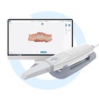 Intraoral Dental Scanner -  free Shipping 