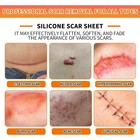 Silicone Scar Sheets  1 6 x60  Roll-1 5m  Silicone Scar Tape For Surgical Scar