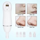 Diamond Dermabrasion Microdermabrasion Pore Cleansing Facial Beauty Machine