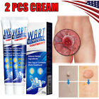 2x Wart Remover Ointment Genital Herpes Genital Antibacterial Treatment Cream Us